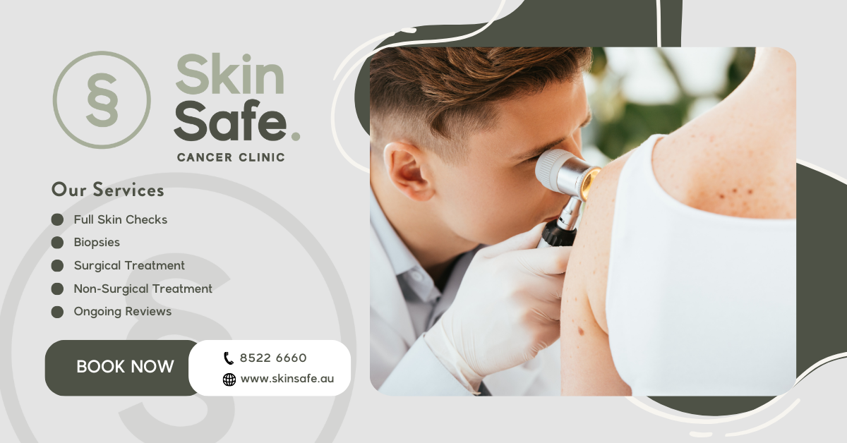 SkinSafe Facebook ad: SkinSafe Cancer Clinic