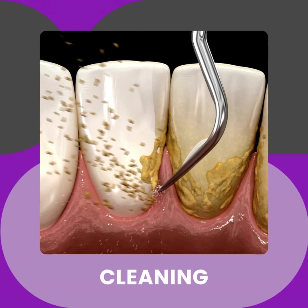 Arrow Dental Center Facebook ad: General & Cosmetic Dentistry | Monroe