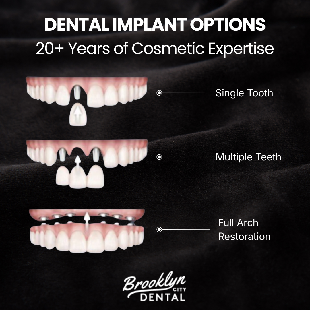 Brooklyn City Dental Facebook ad: Schedule Your Consultation Today!