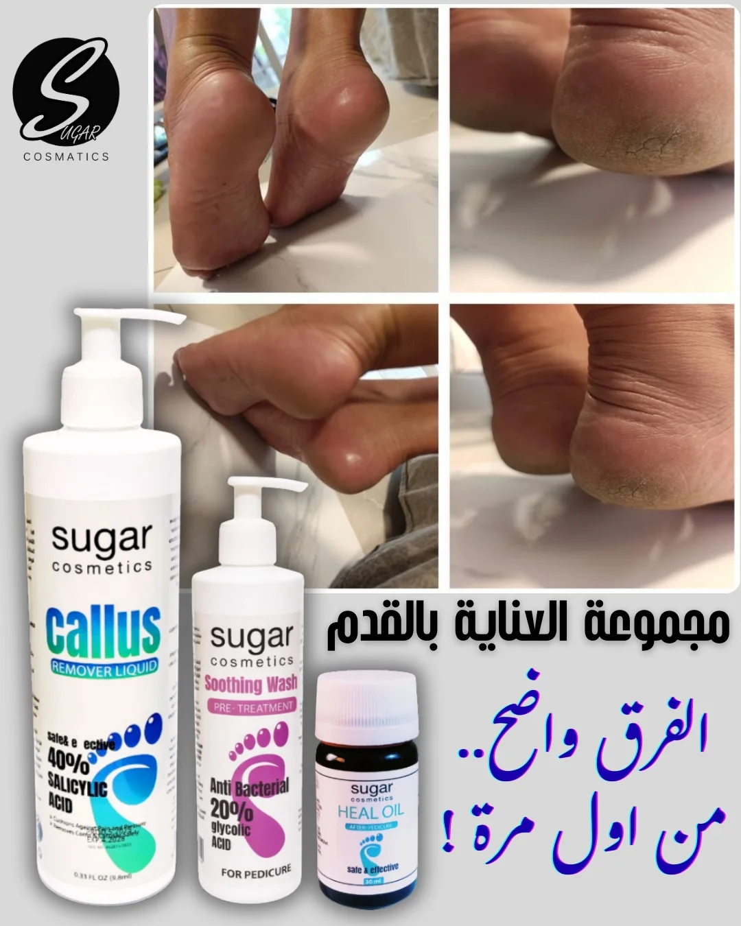 Sugar cosmetic Facebook ad: الفرق واضح ولا محتاج كلام