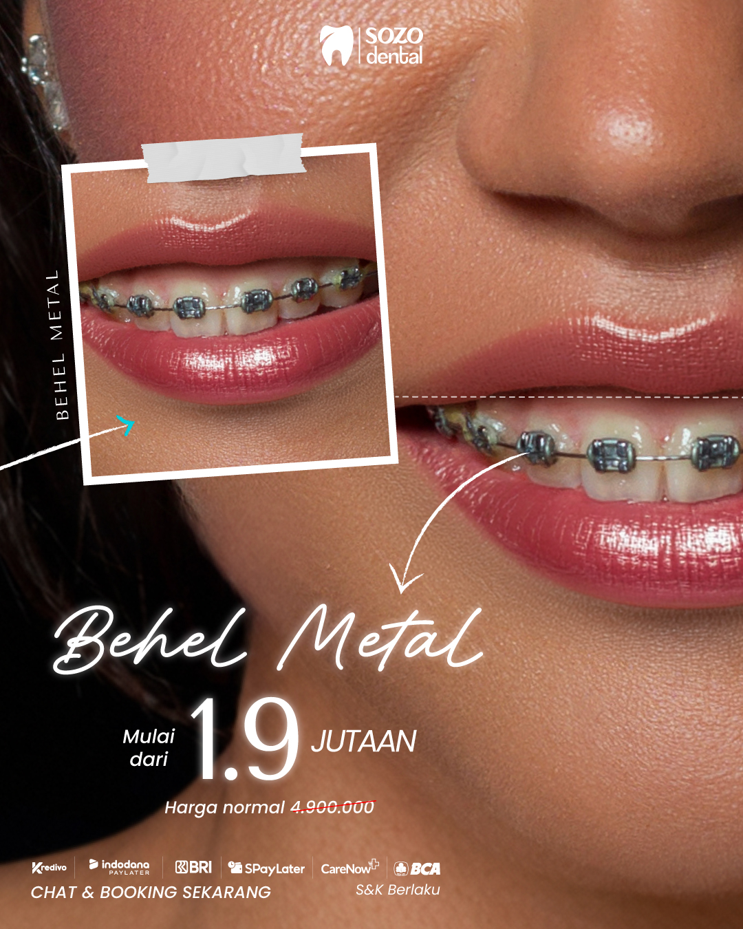 Sozo Dental Clinic Facebook ad