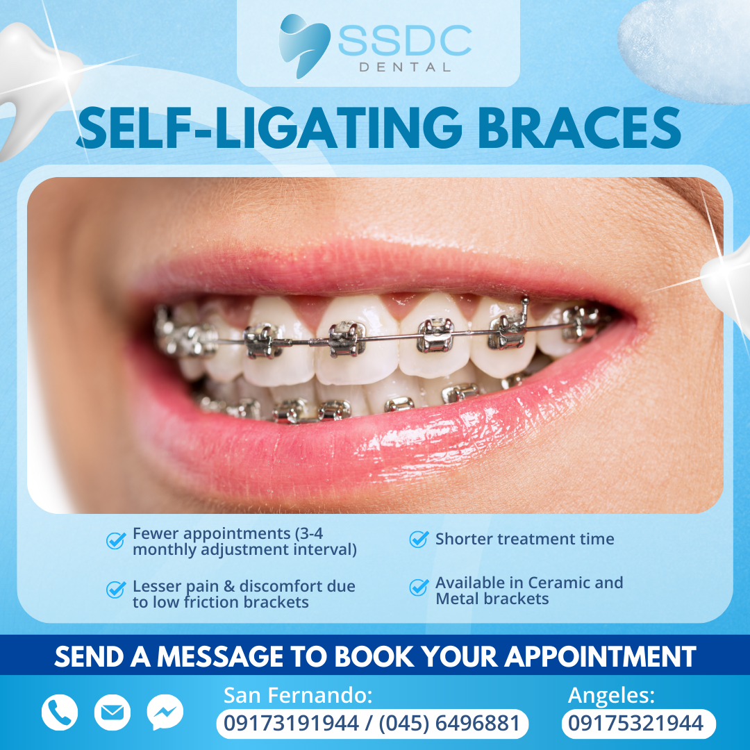 SSDC Dental Facebook ad