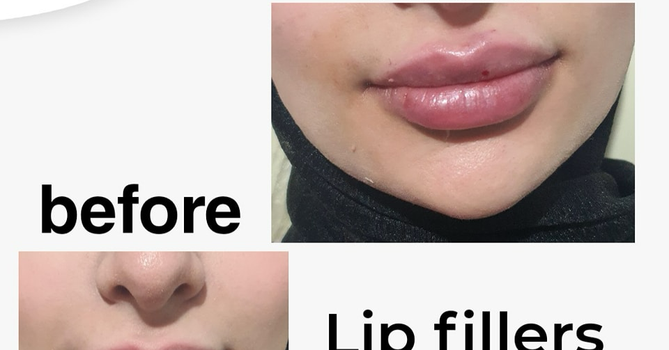 Magic skin clinics Facebook ad