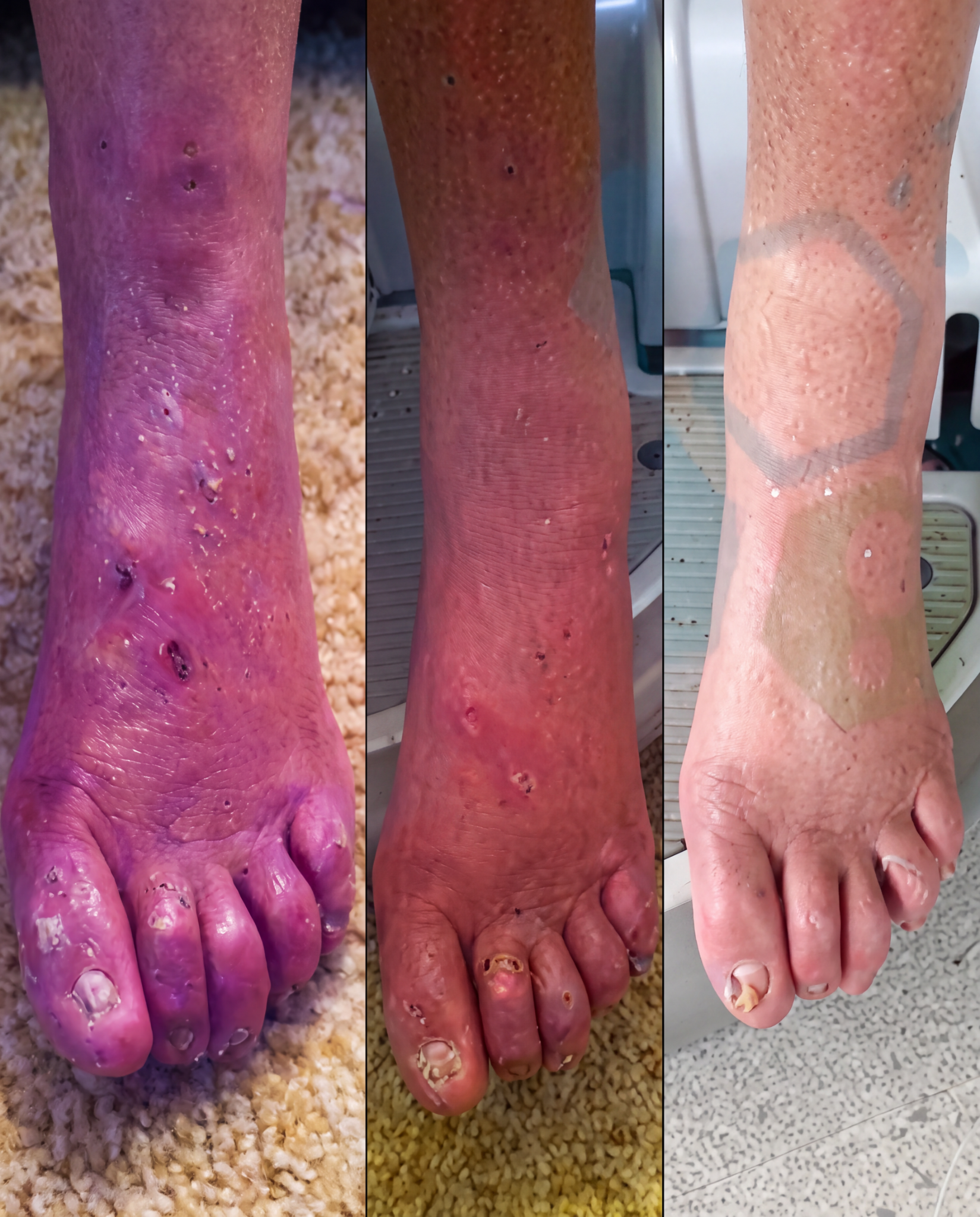 Dr. Benjamin Carter, MD Facebook ad: Put an End to Neuropathy Pain for Good?