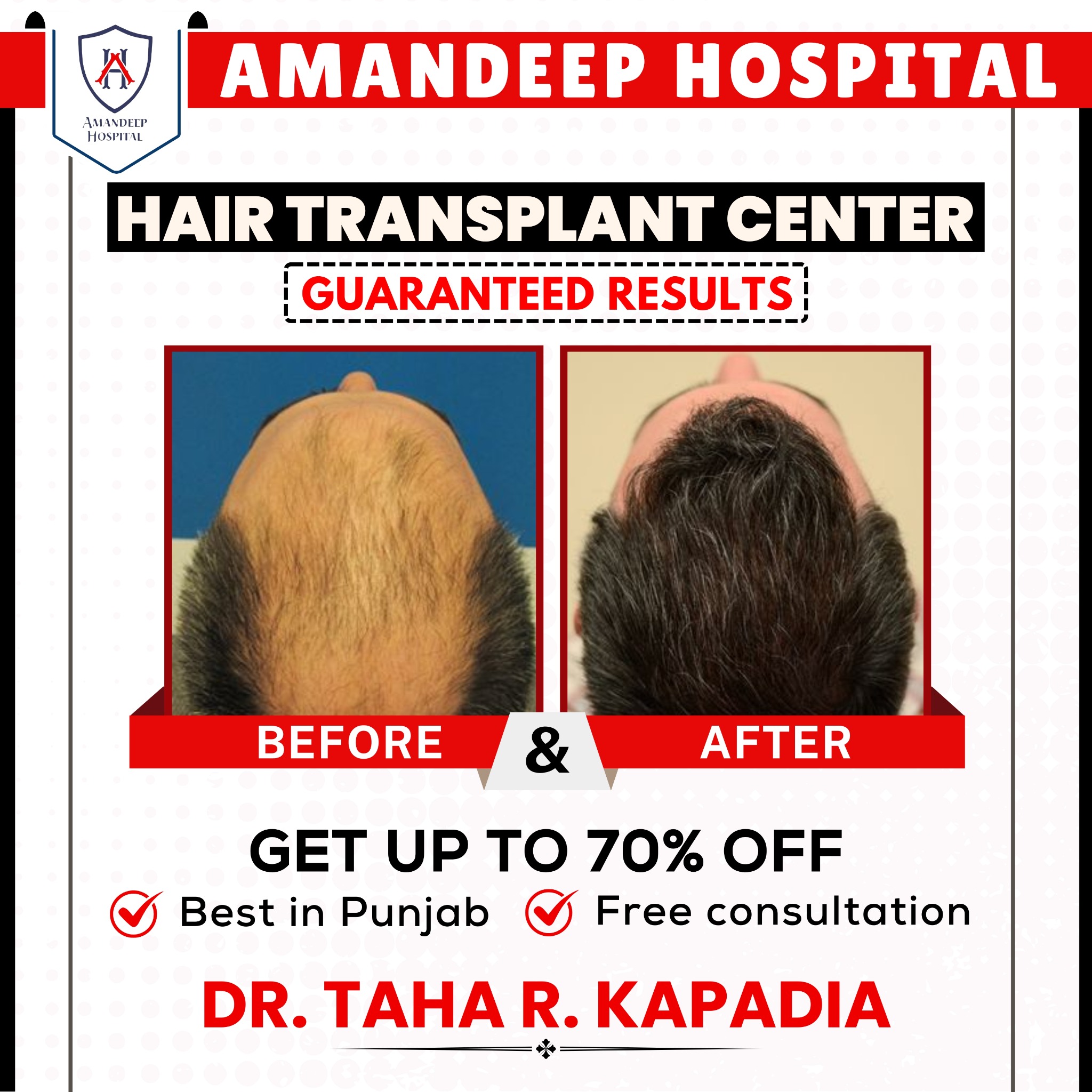 Amandeep Hair Transplant Facebook ad: Limited Time Offer: FREE Consultation + Get Up…
