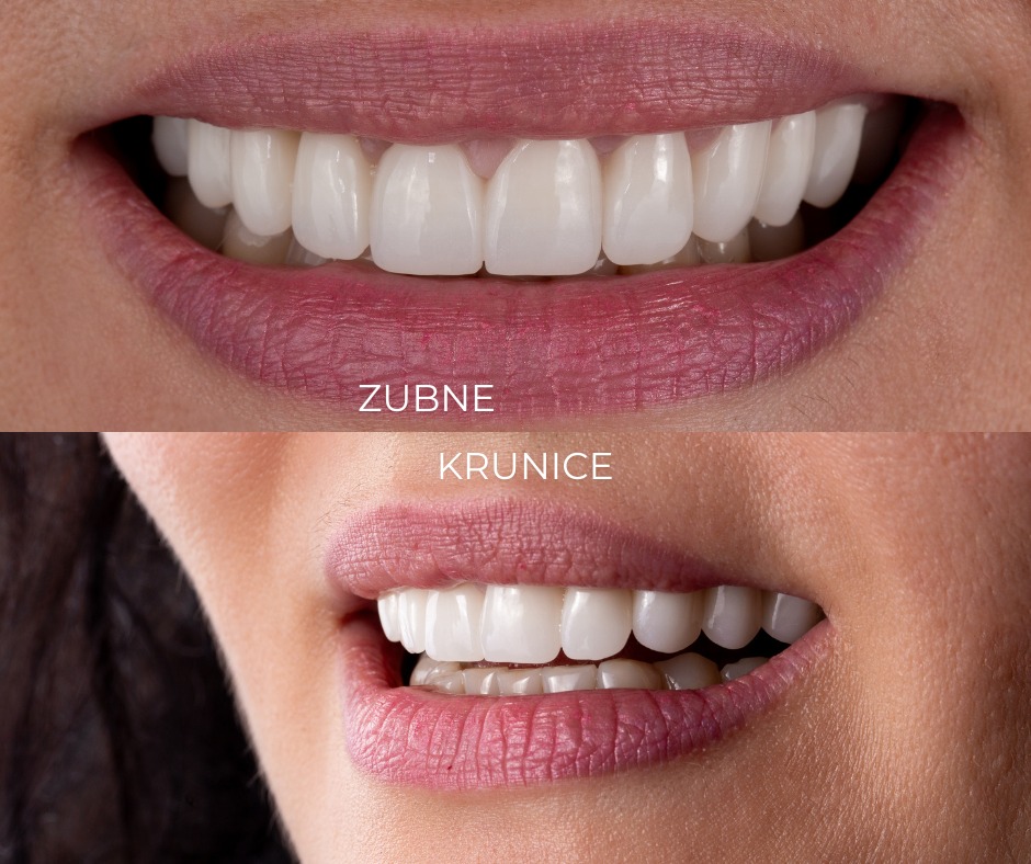 Arena Dental Facebook ad