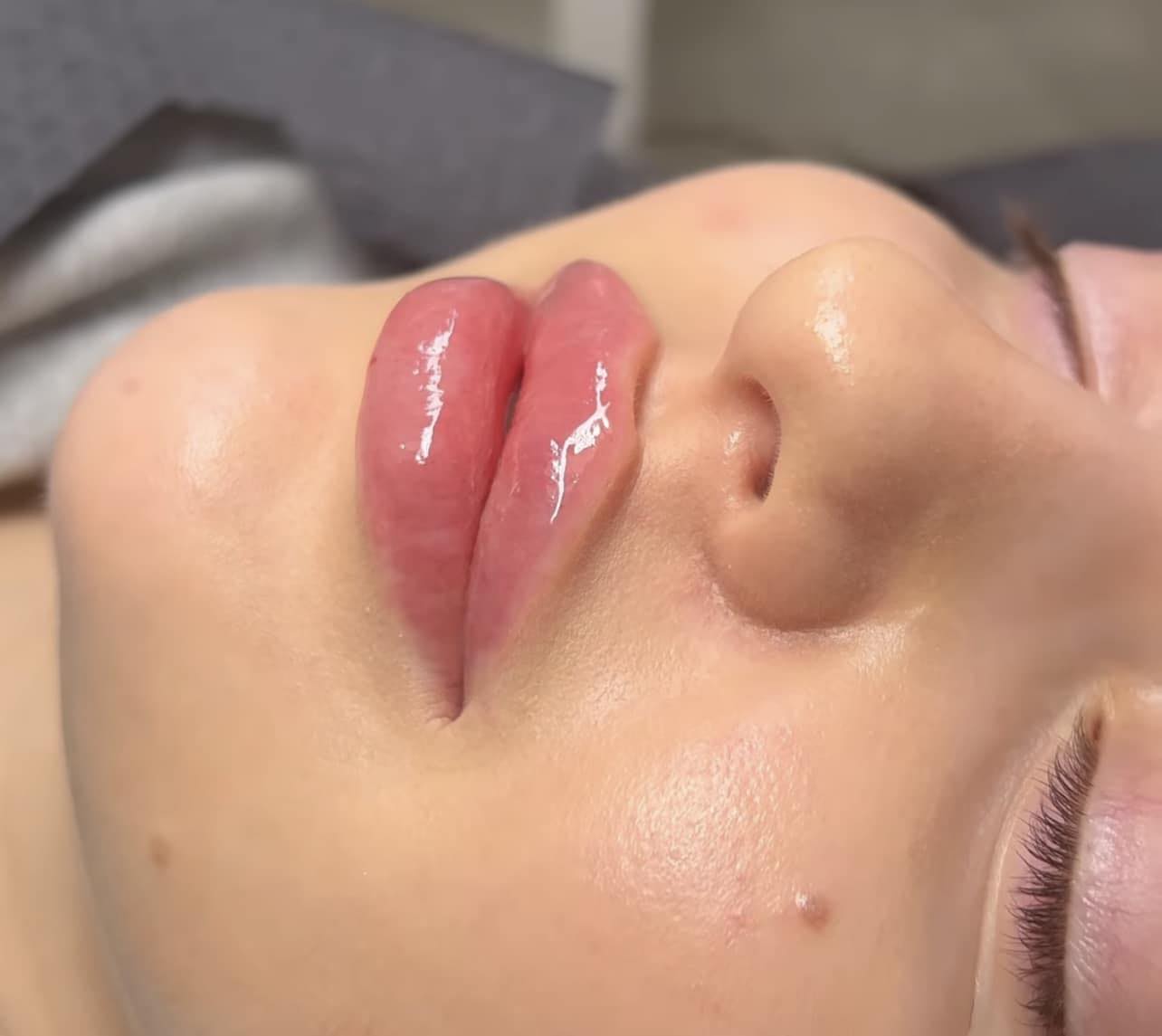 Angélica Rodríguez Beauty Center Facebook ad: Relleno de Labios con Ácido Hialuronico
