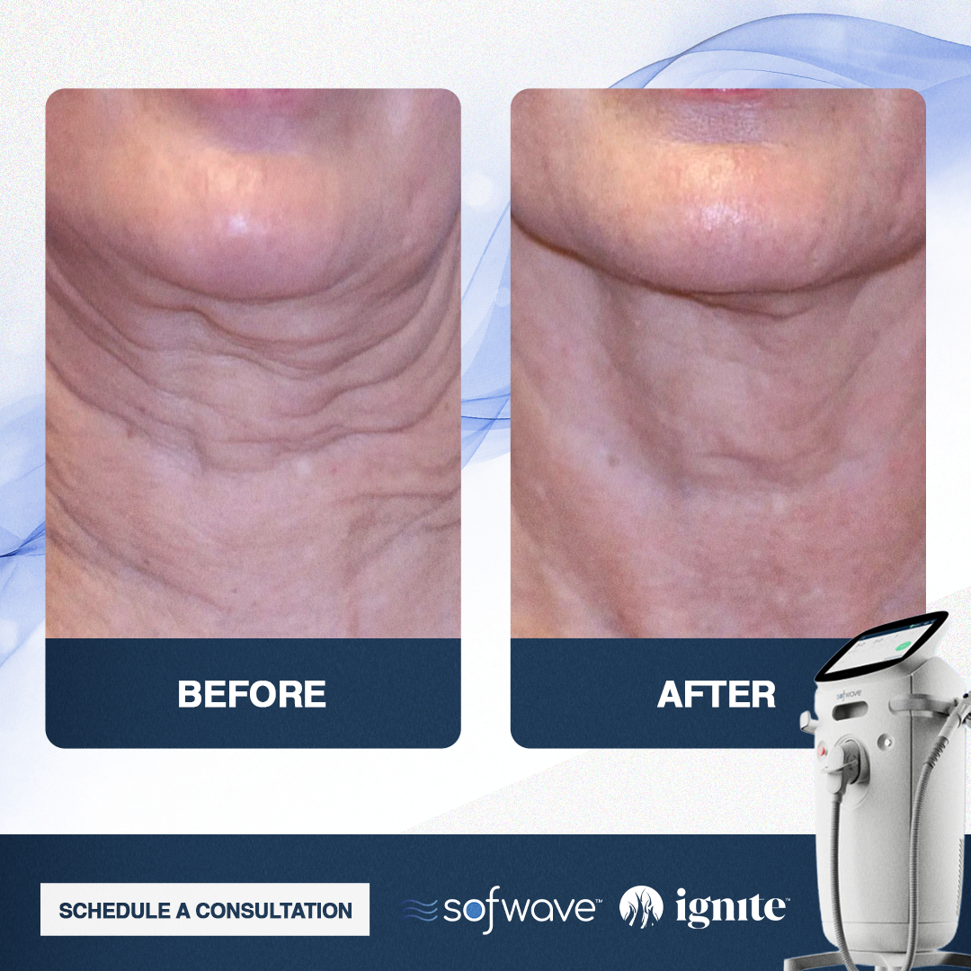 Ignite Orthopaedic & Wellness Clinic Facebook ad
