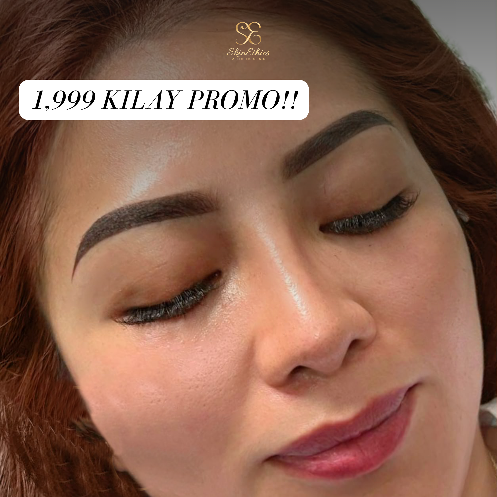 Skin Ethics Aesthetic Clinic Facebook ad