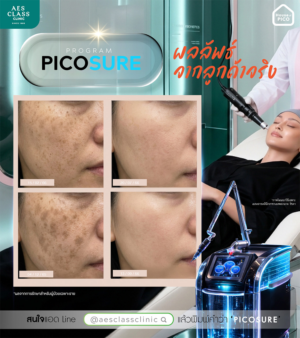 AES CLASS Clinic เอสคลาสคลินิก Facebook ad: ผลลัพธ์จากลูกค้าจริง! หลังรักษา ‘ฝ้า กระ’ ด้วยโปรแกรม…