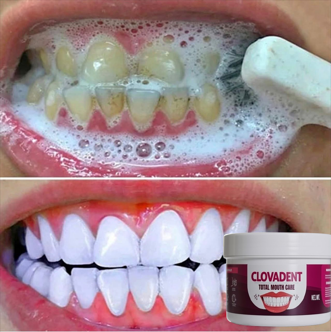 Clovadent Mouth Care Facebook ad: FREE delivery oday