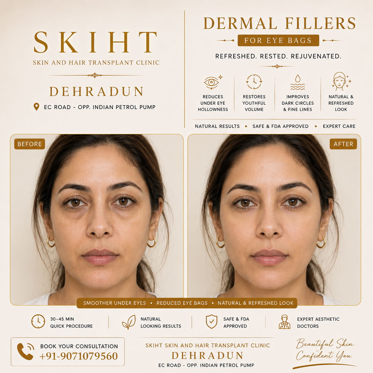 SKIHT - Skin & Hair Transplant Clinic Dehradun Facebook ad: SKIHT - Dehradun's #1 Skin & Hair Transplant Clinic…