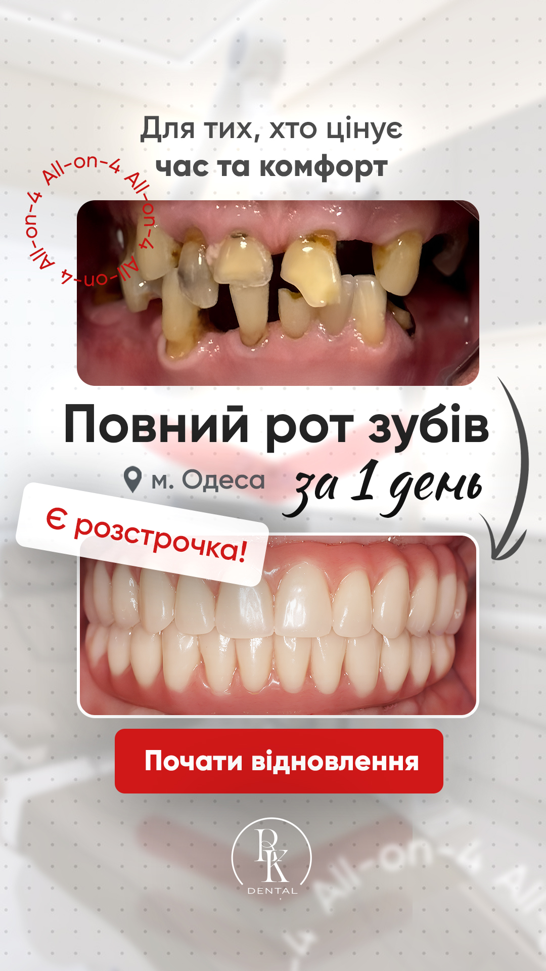 RK.Dental Facebook ad from Feb 26, 2026