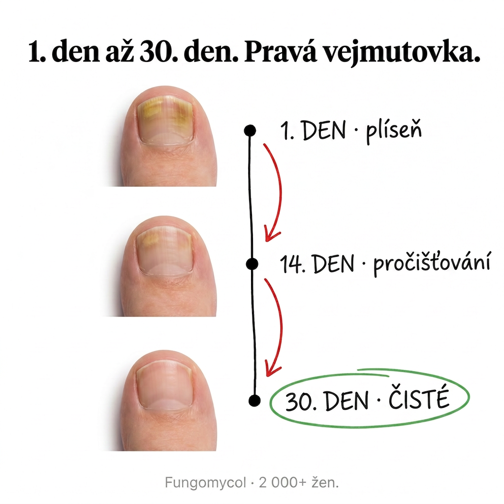 Organická Kosmetika - InaEssentials.cz Facebook ad: Den 1 plíseň. Den 30 zdravé nehty.