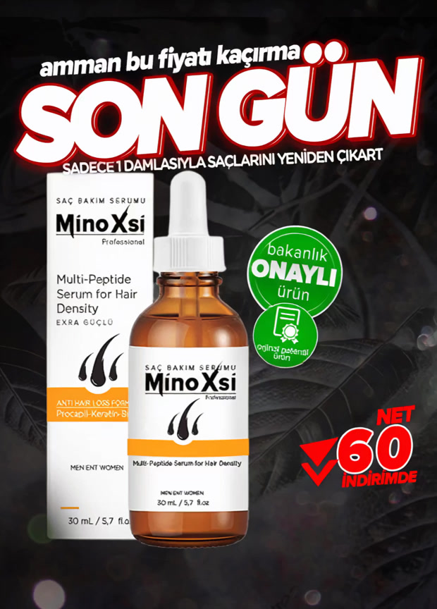 Minoxsi7 Facebook ad: İNDİRİMİ KAÇIRMA->