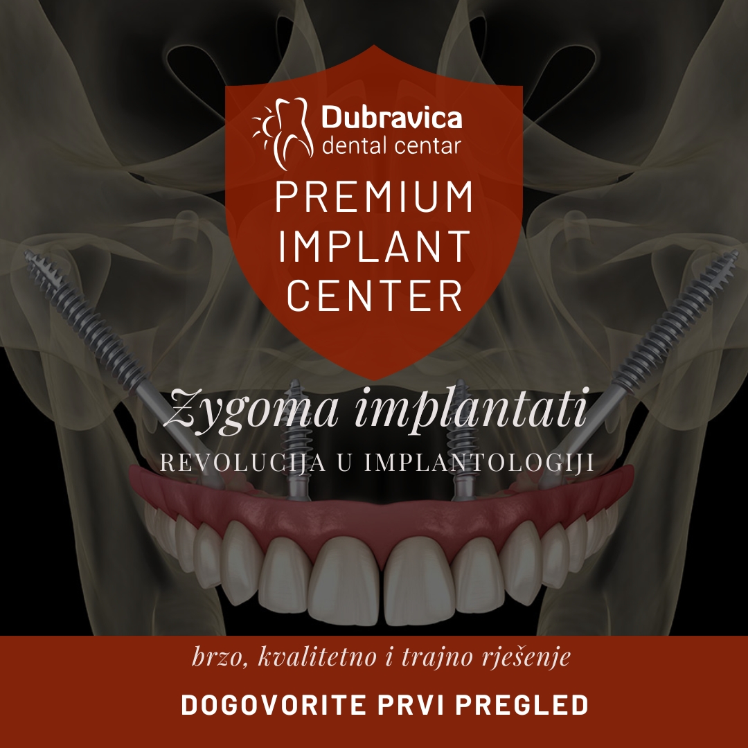 Dental Centar Dubravica Facebook ad: Zygoma implantati