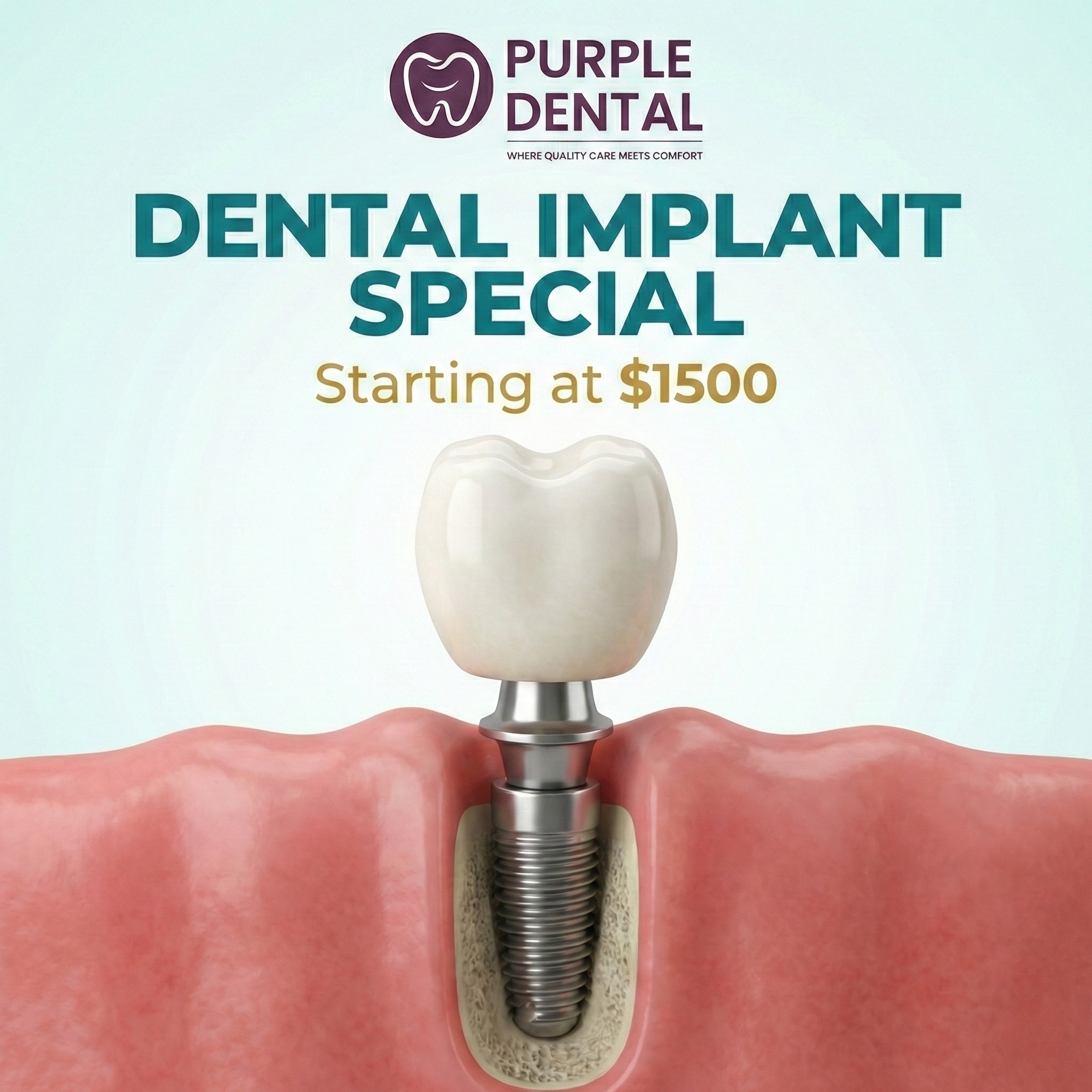 Purple Dental Facebook ad: Transform Your Smile with Dental Implants Starting at…
