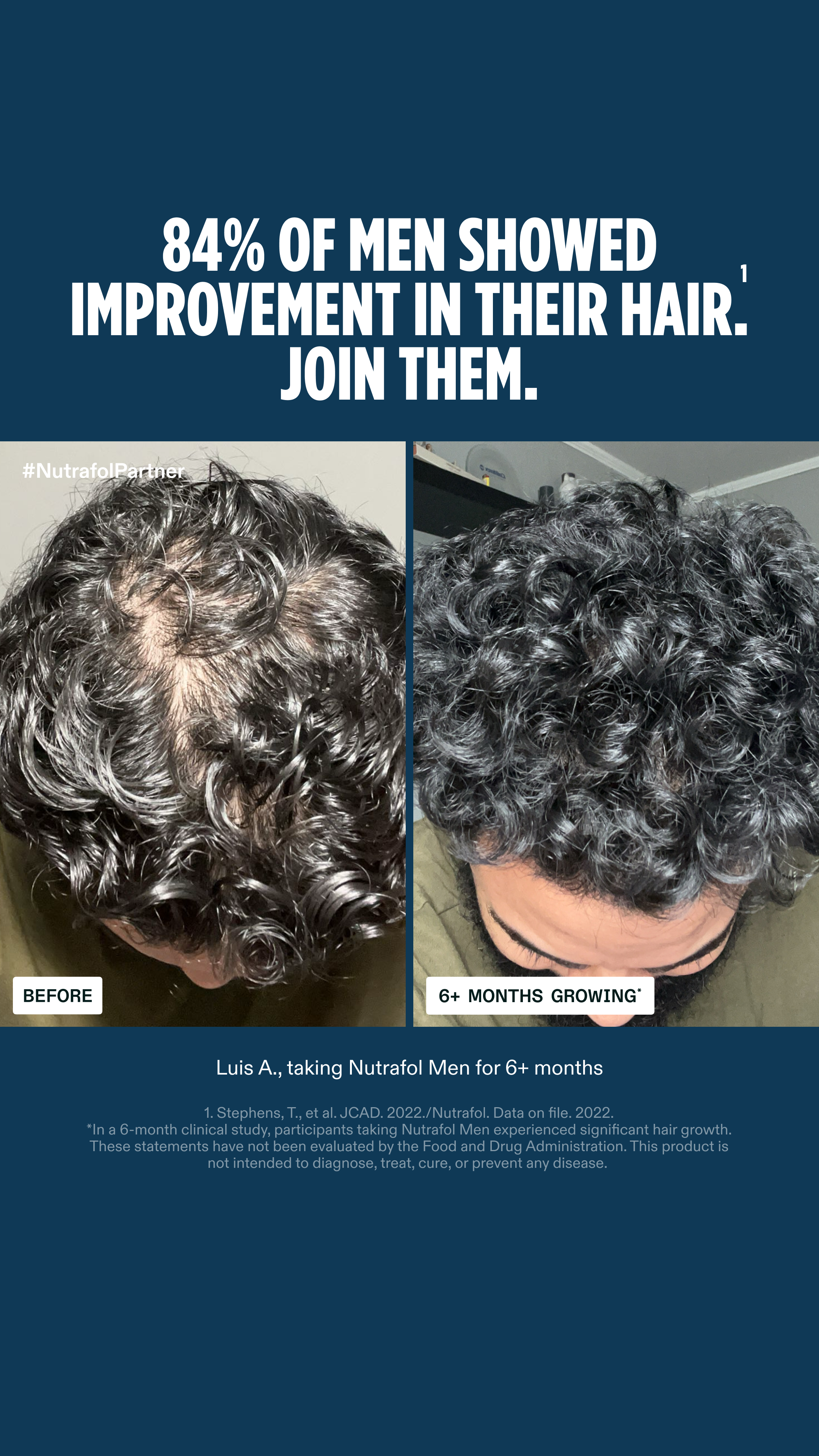 Nutrafol Men Facebook ad