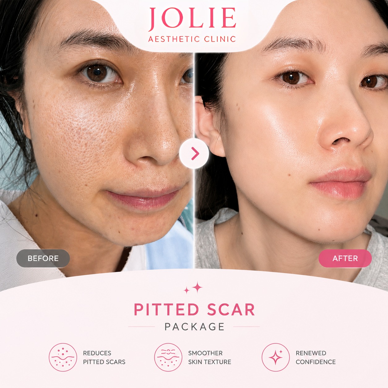 Jolie Beauty Ageless Facebook ad