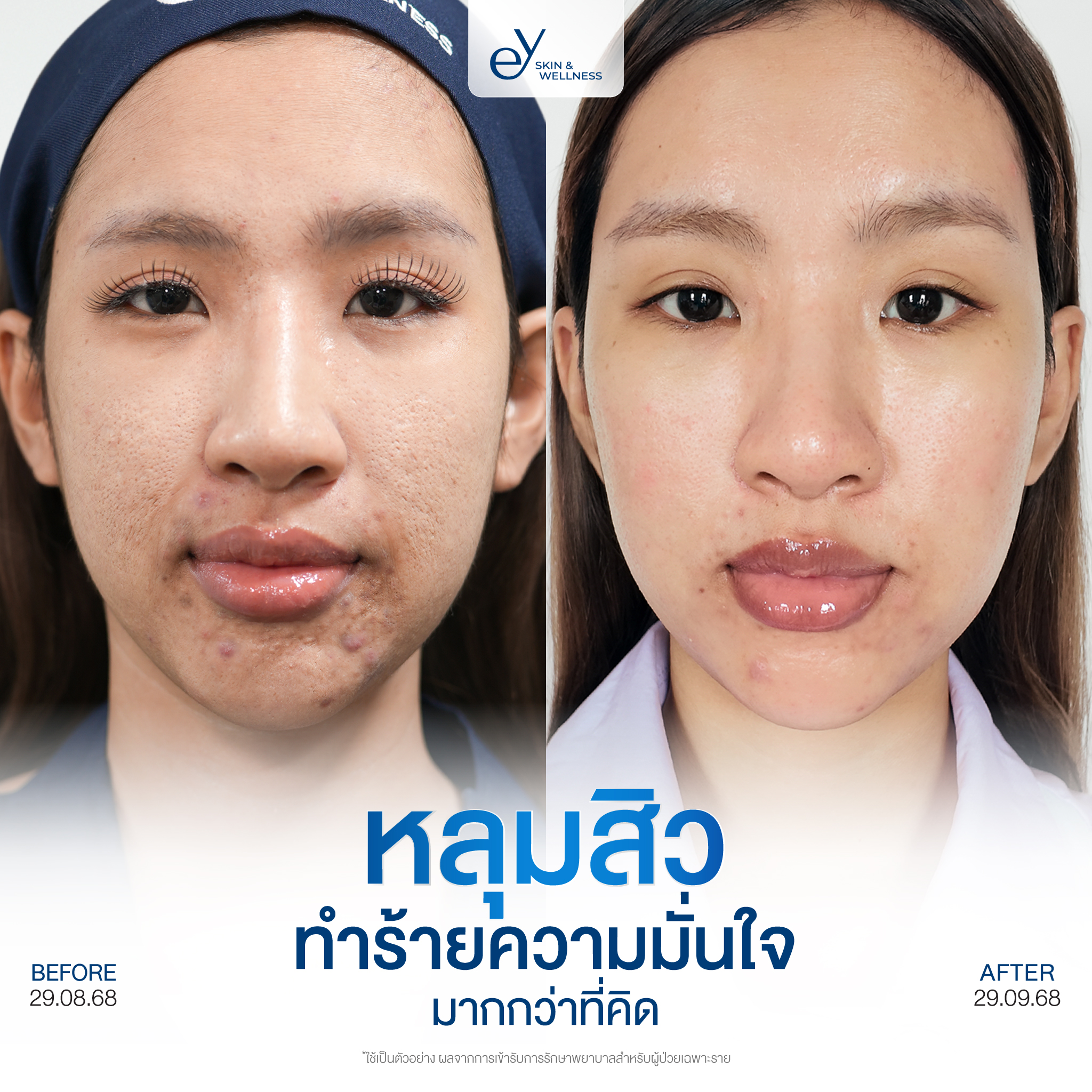 EY Clinic Facebook ad: หลังจากที่ได้เข้ารับการดูแลรักษา