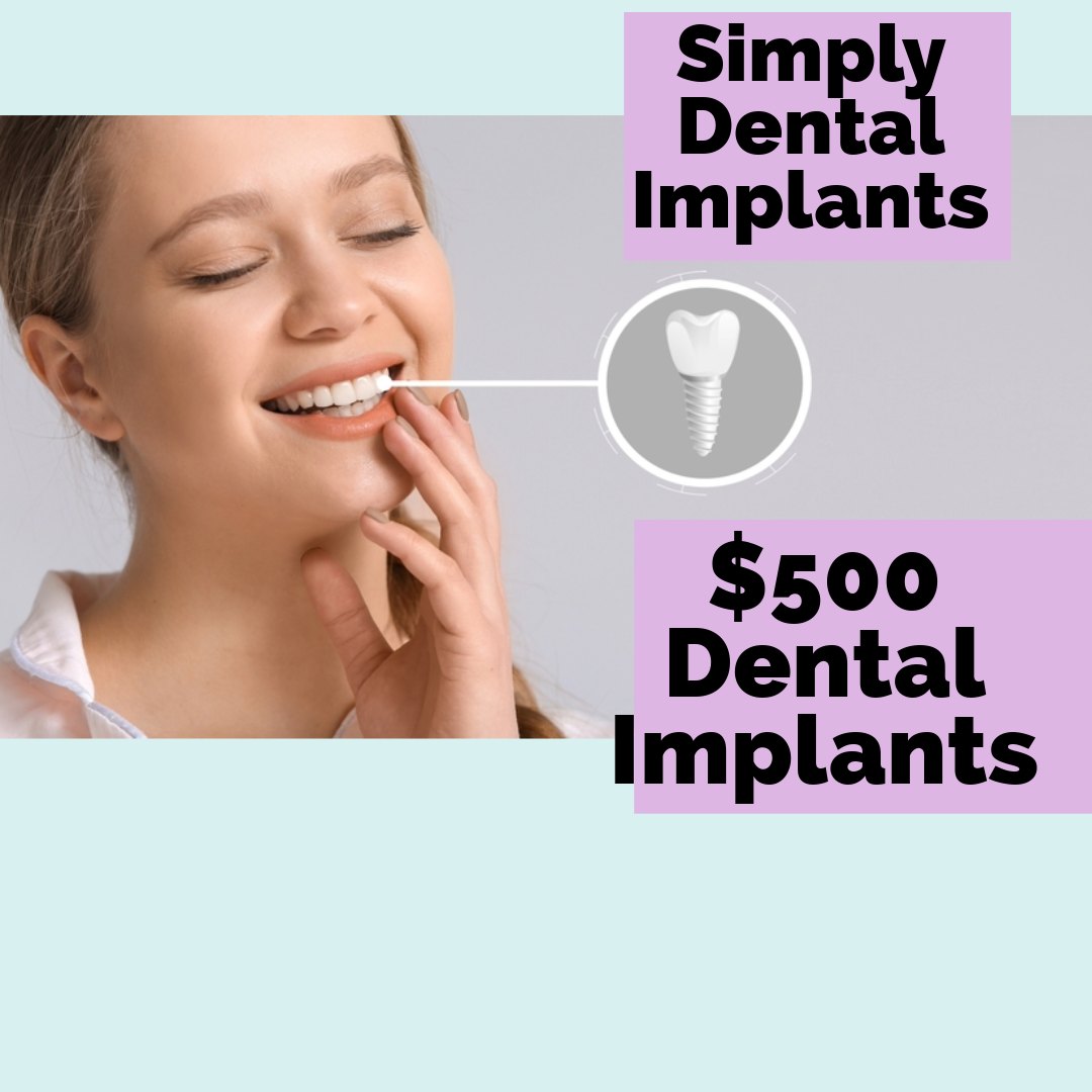 Simply Dental Implants Facebook ad: $500 Dental Implants.