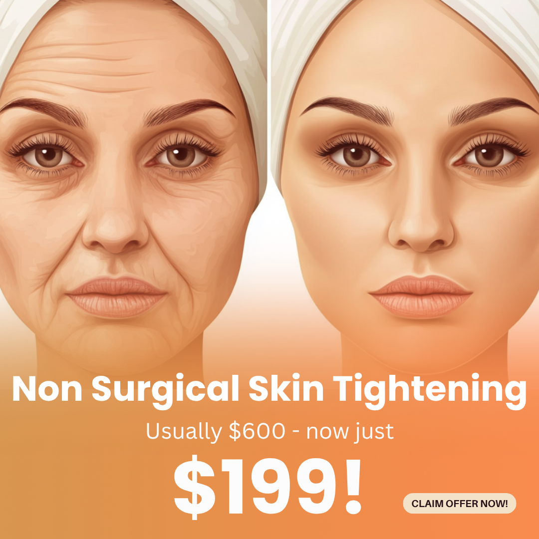 Petras Weight Loss Clinic Facebook ad: Non-Surgical Skin Tightening for ONLY $199!