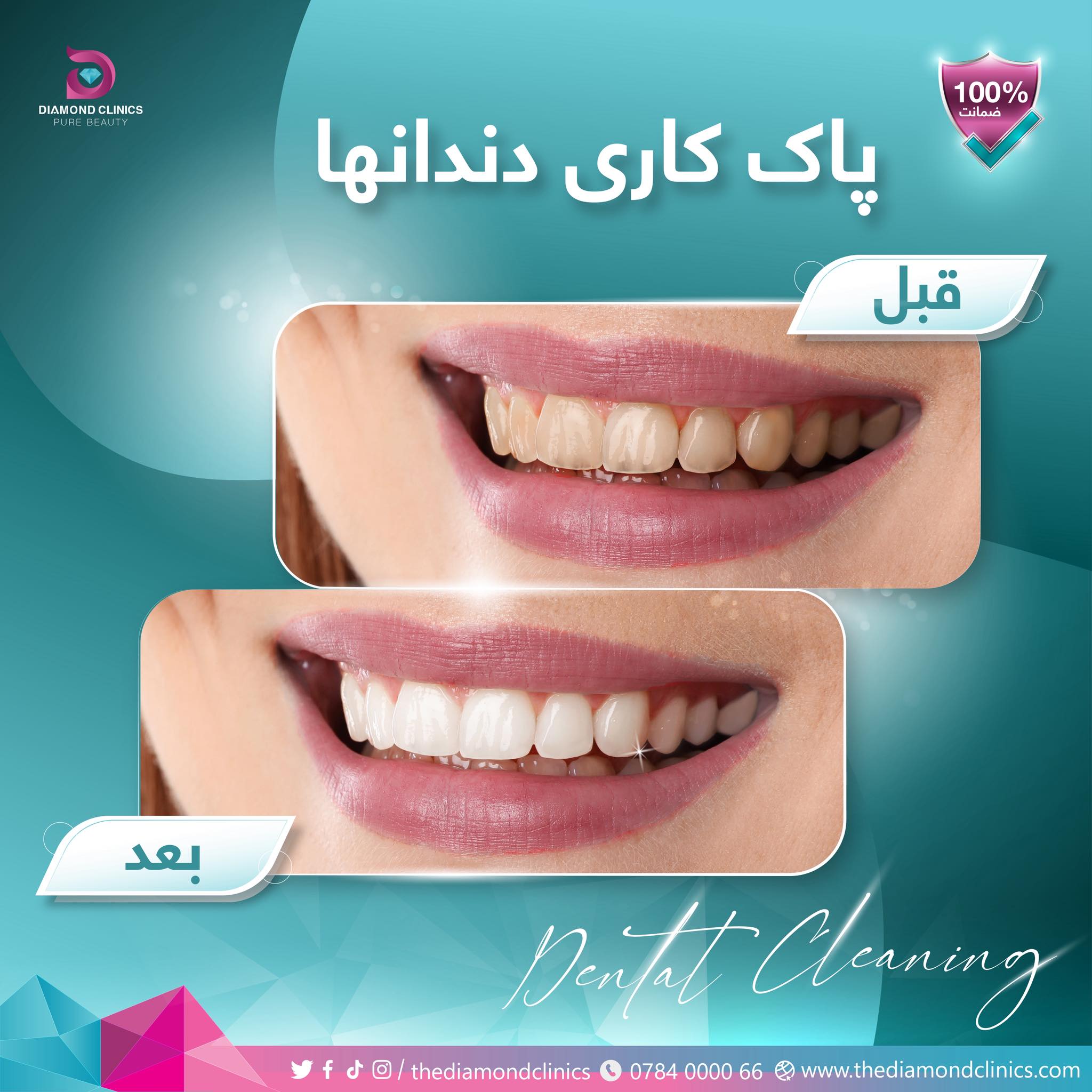 کلینیک دندان دایمند - Diamond Dental Clinic Facebook ad