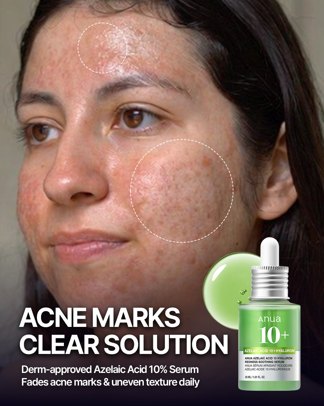 ANUA_Global Facebook ad