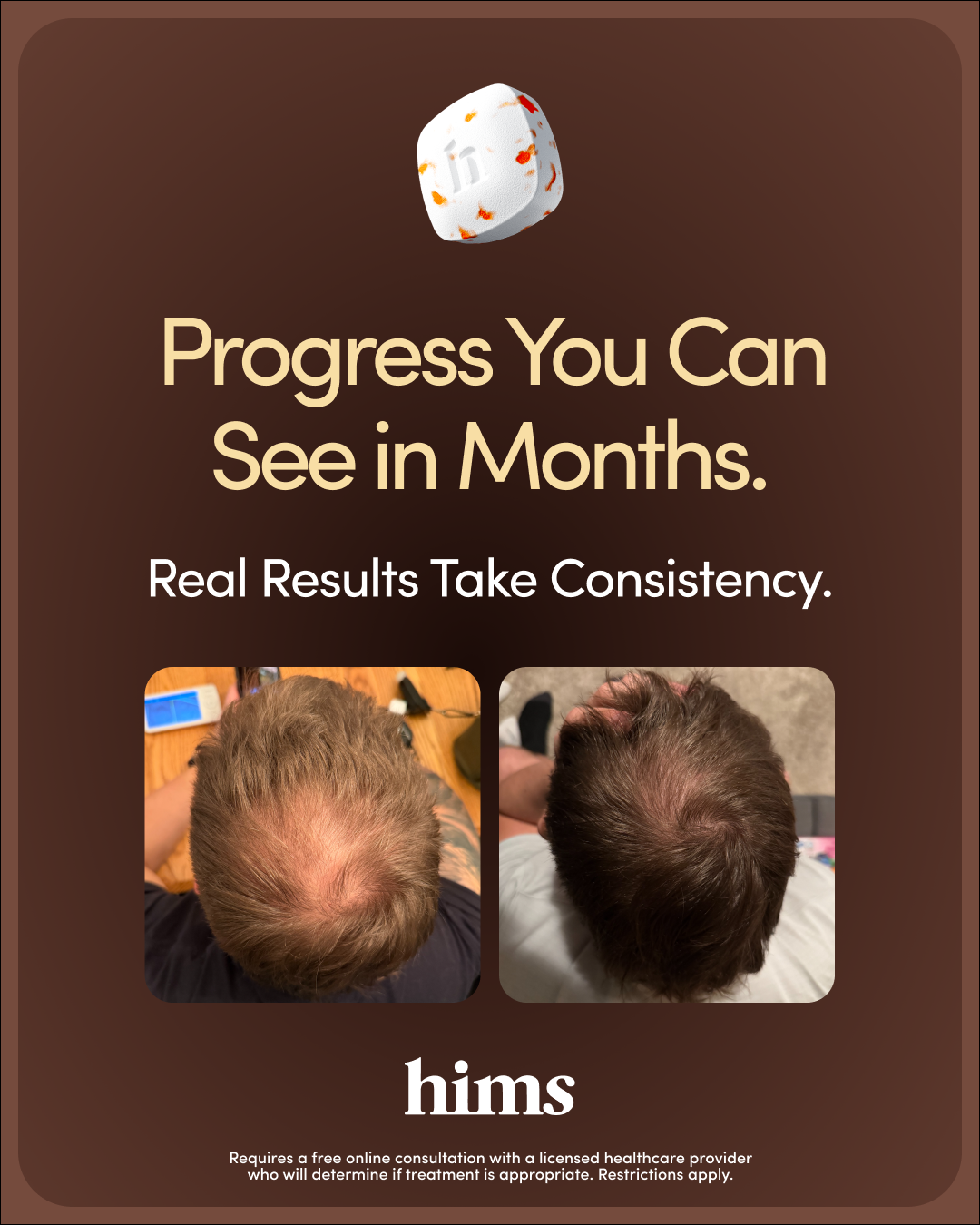 hims Facebook ad