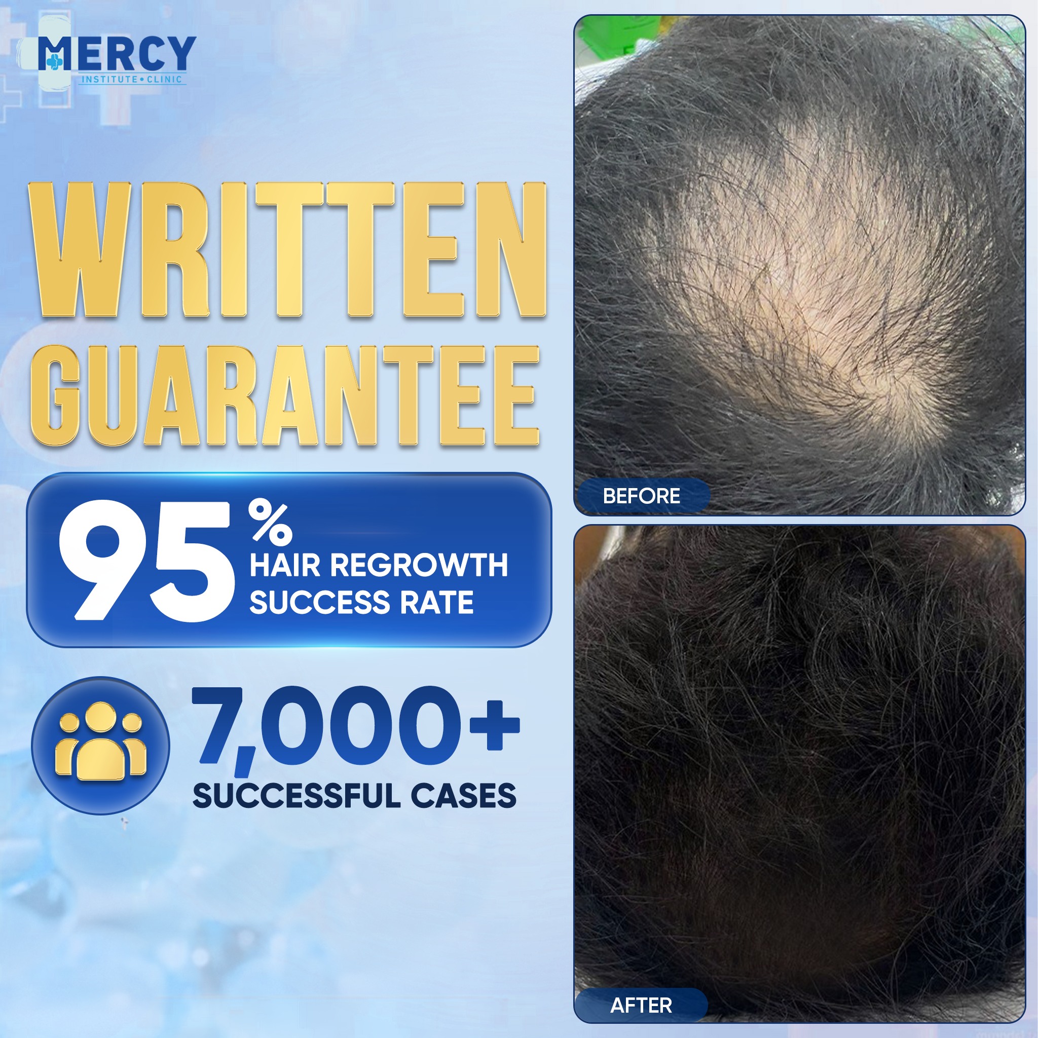 Mercy Hair Growth in the Davao Facebook ad: POSTPARTUM HAIR LOSS THAT KEEPS GETTING WORSE?