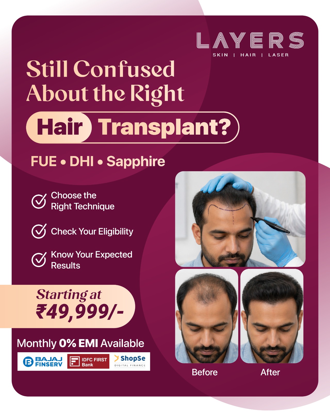 Layers Clinics - Skin & Hair Facebook ad