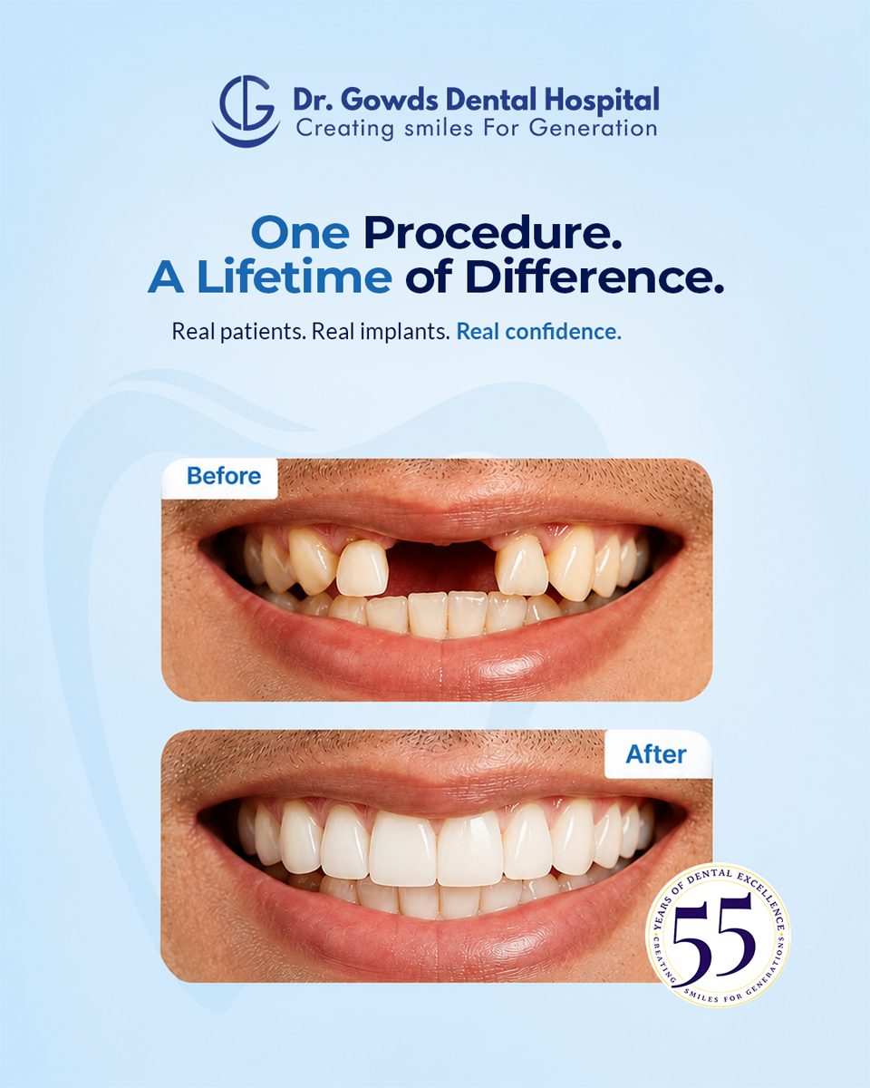 Dr. Gowd's Dental Hospital Facebook ad: Explore dental implant options at Dr Gowds Dental…