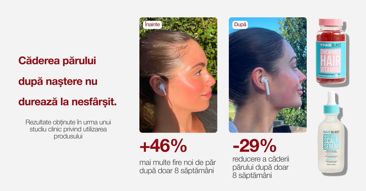 Hairburst Romania Facebook ad