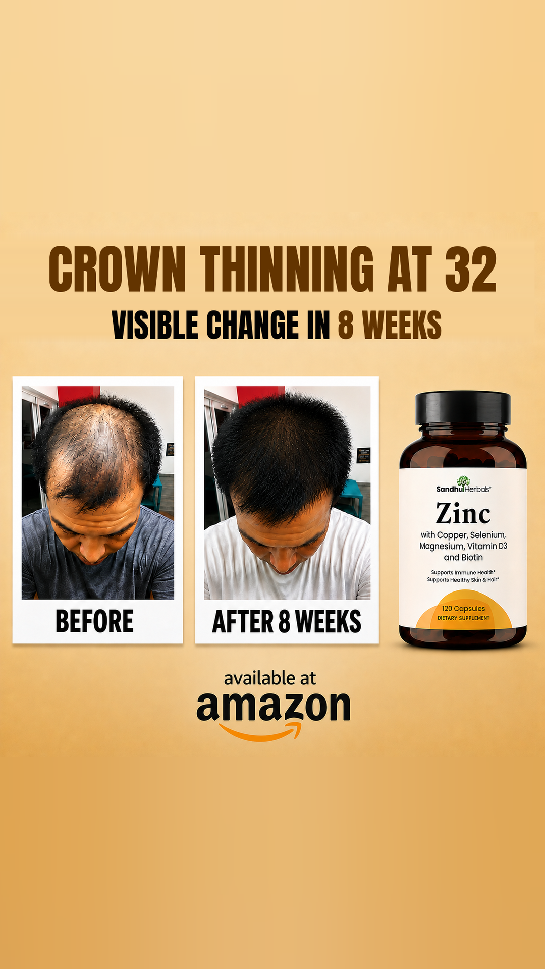 Sandhu Herbals Facebook ad: Crown Thinning At 32 Isn't Bad Luck, It's A Nutrient Hole