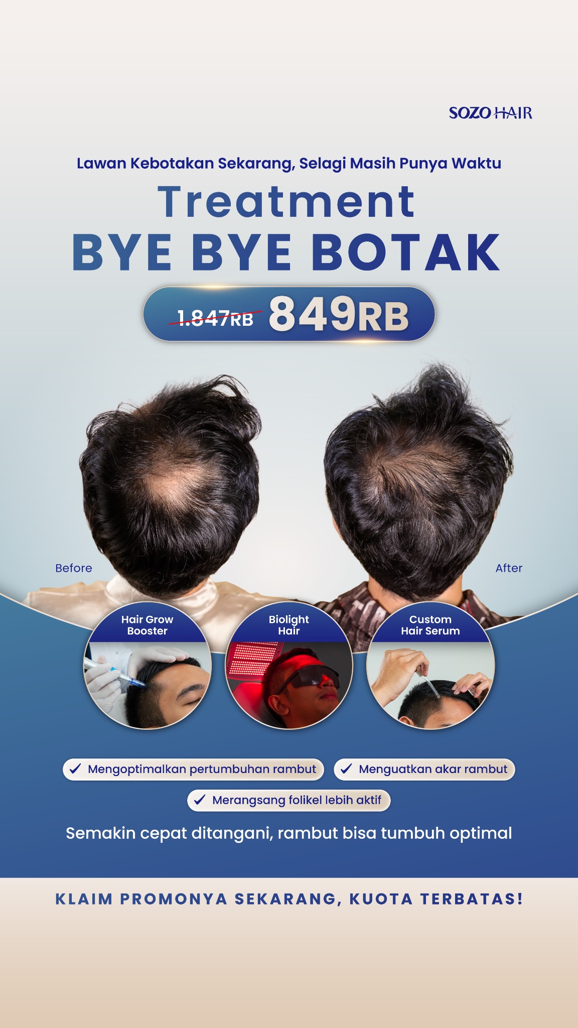 SOZO Hair Science Facebook ad