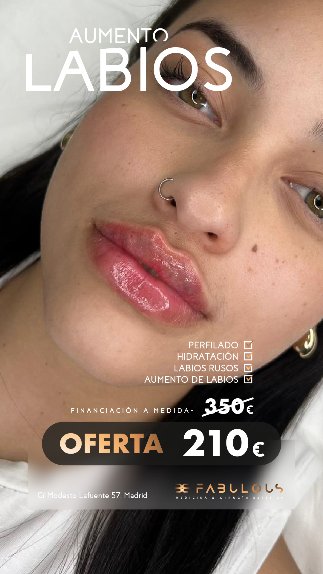 Clínica Be Fabulous Madrid Facebook ad from Jun 19, 2026