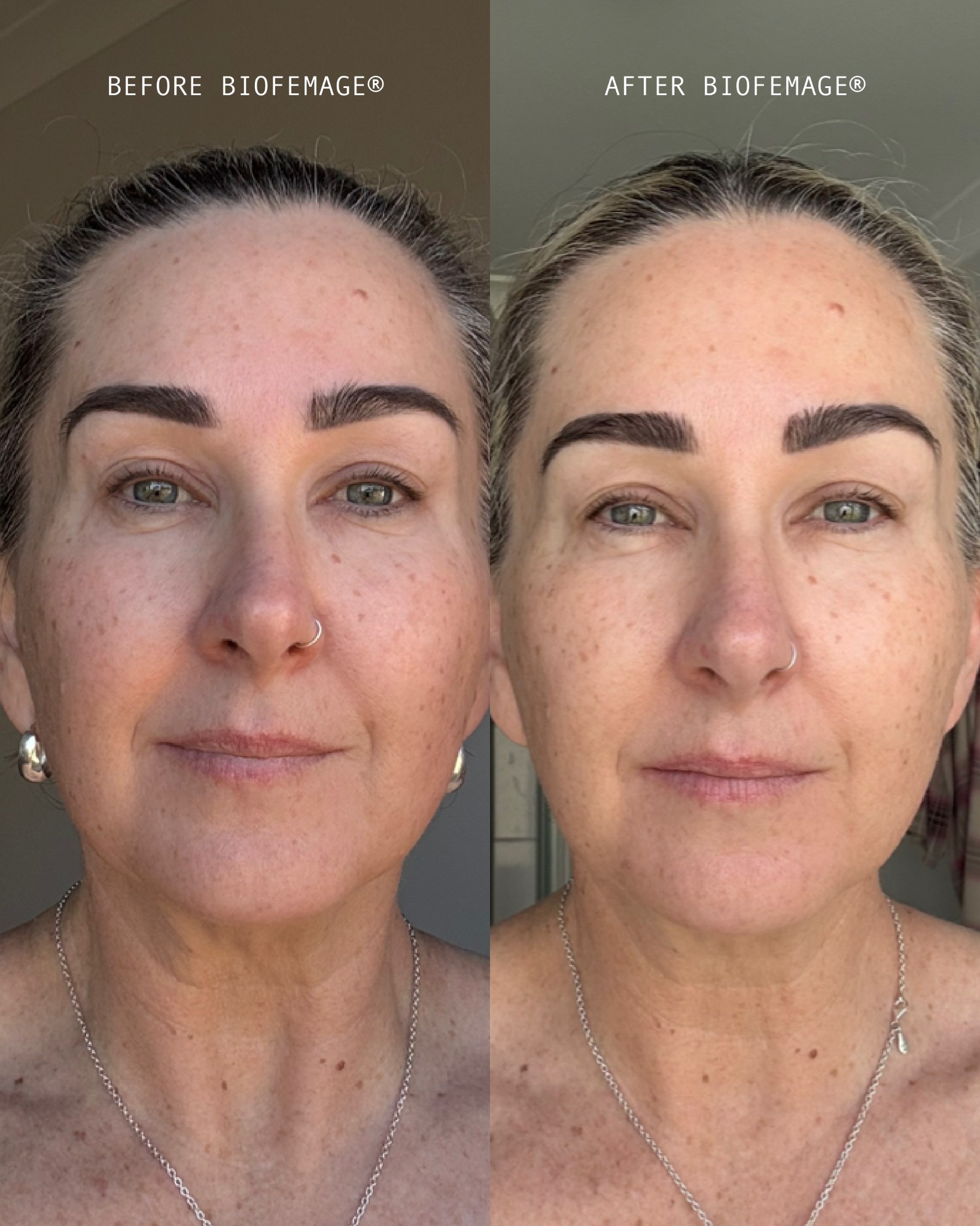 Aesthetics Rx Skincare Facebook ad