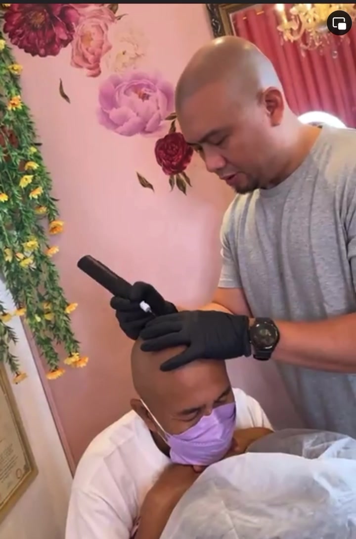Ink Scalp PH Facebook ad: Scalp Micro Pigmentation