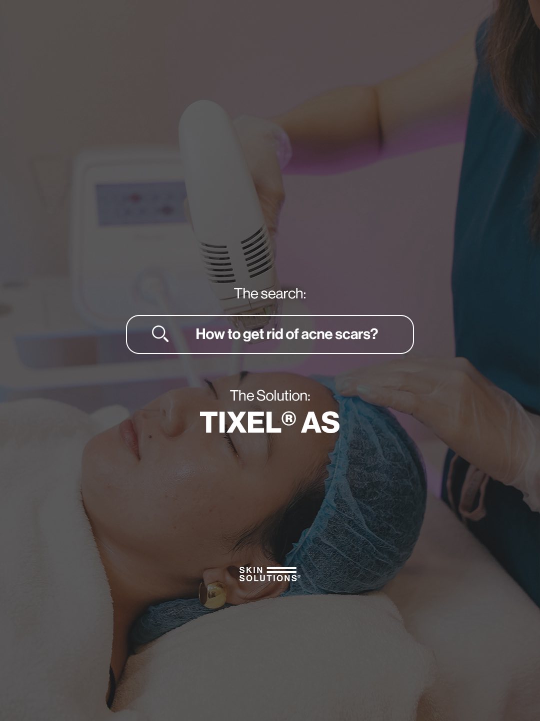 Skin Solutions Facebook ad
