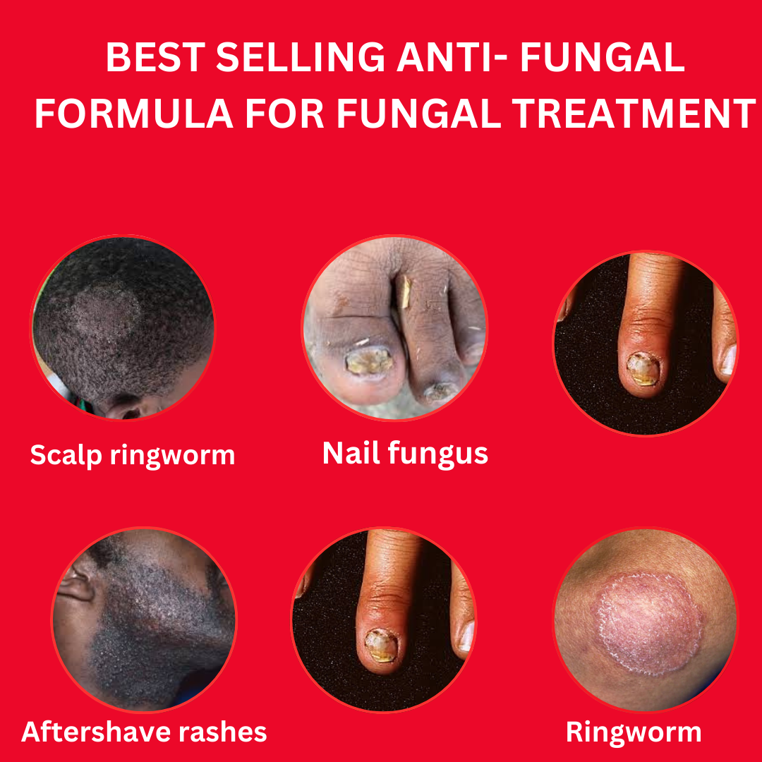 Fungal Natural Remedy Facebook ad