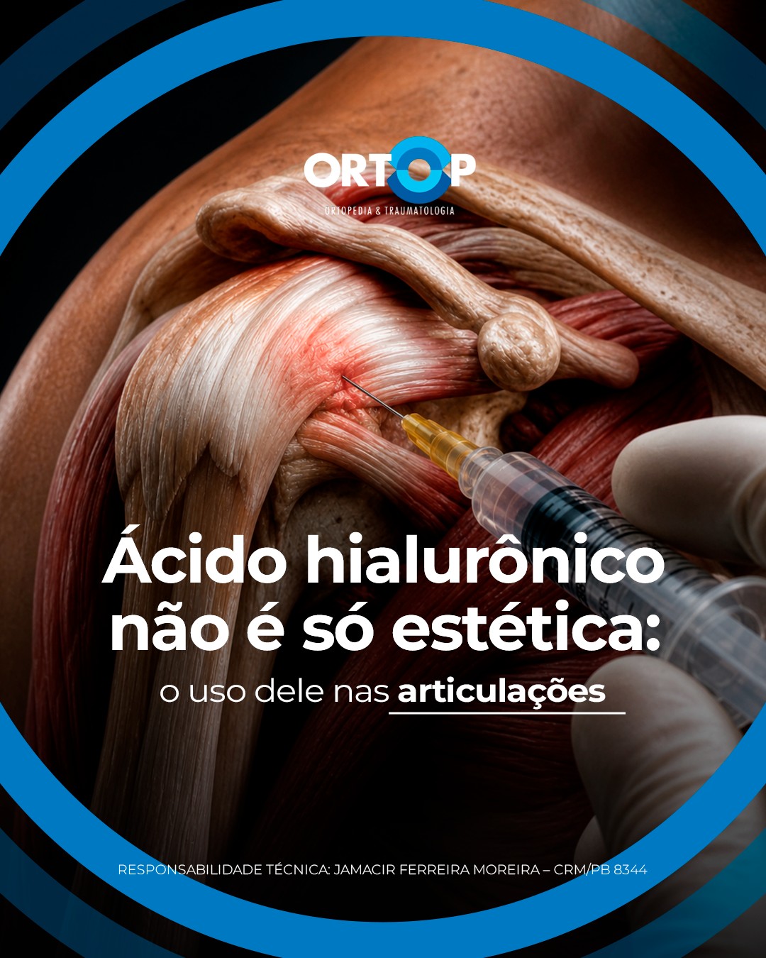 Ortop Clínica Facebook ad: Quando se fala em ácido hialurônico, muita gente…