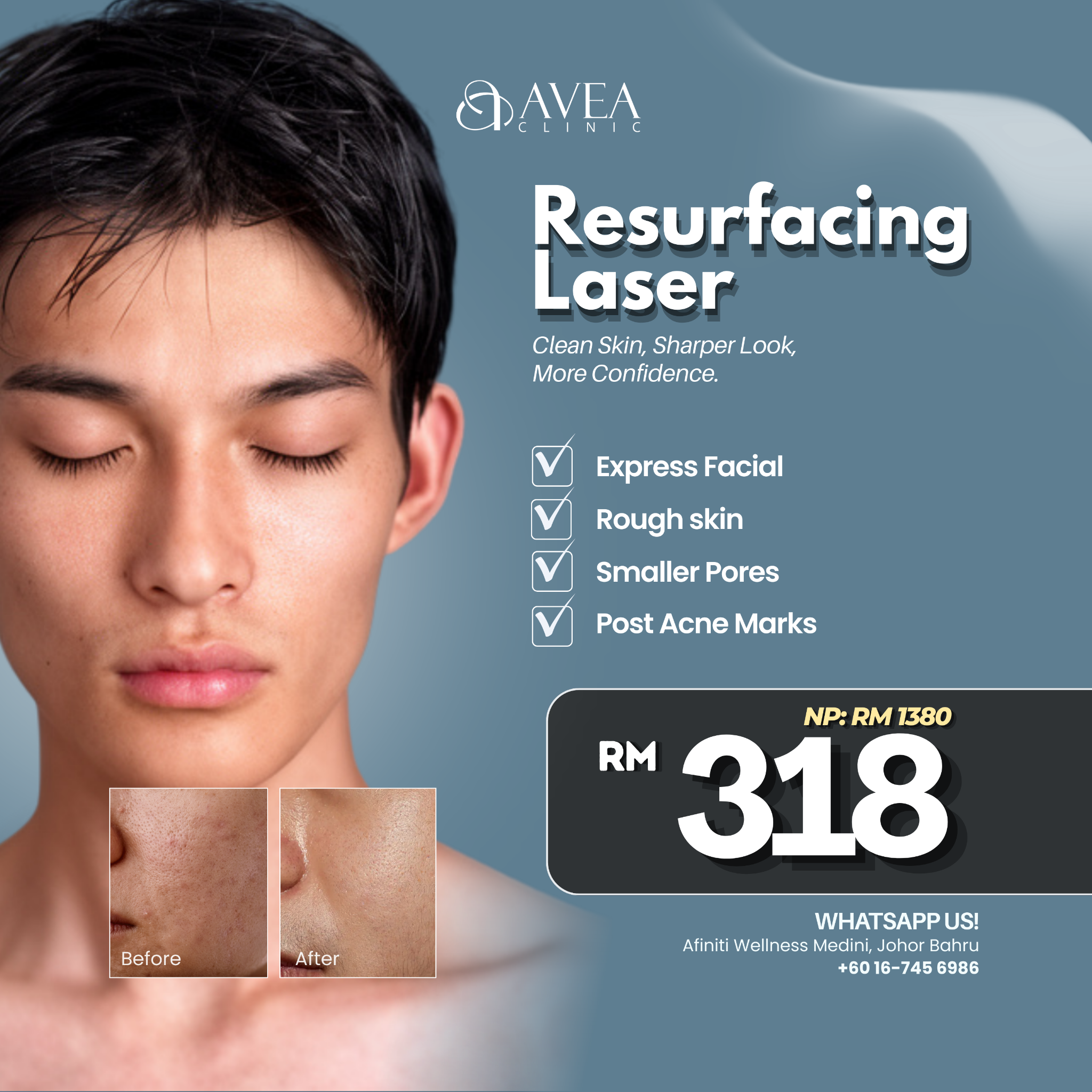 Avea Clinic Facebook ad: Whatsapp Us!