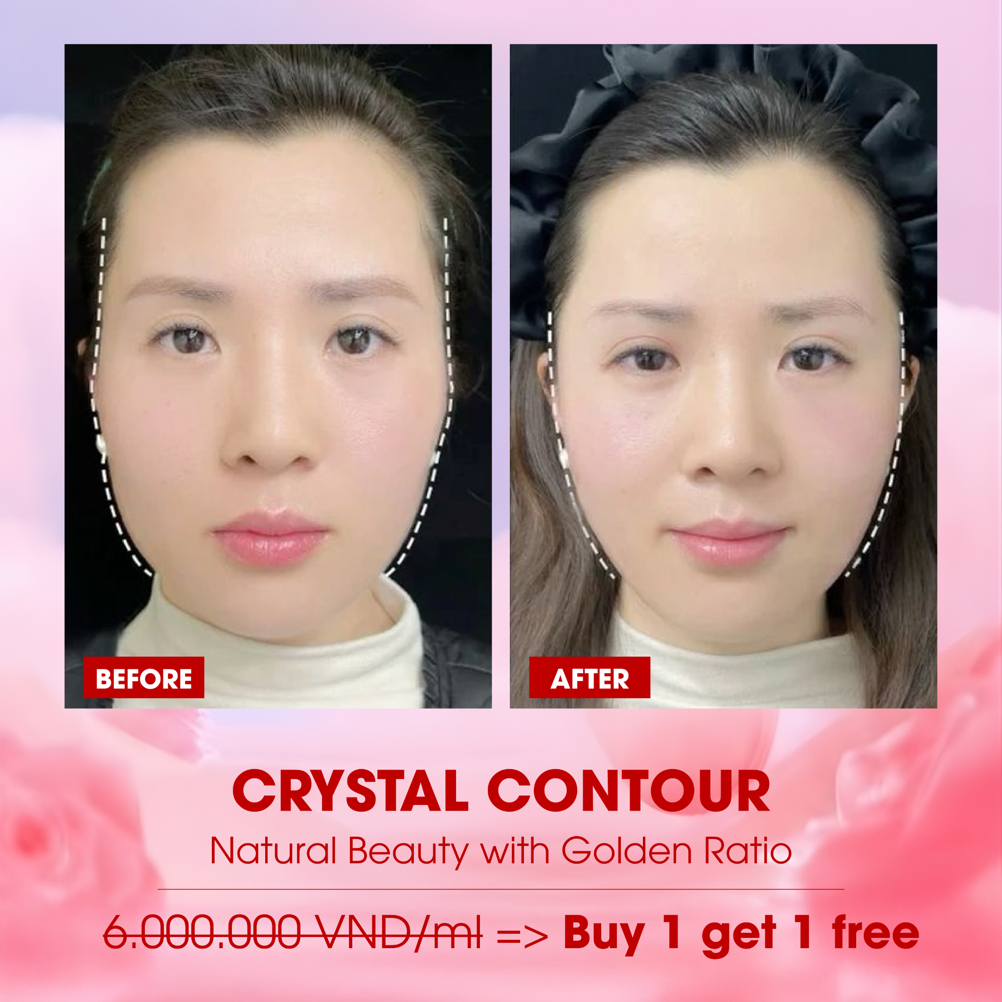 Oceania Spa & Clinic Facebook ad: Chat với chúng tôi