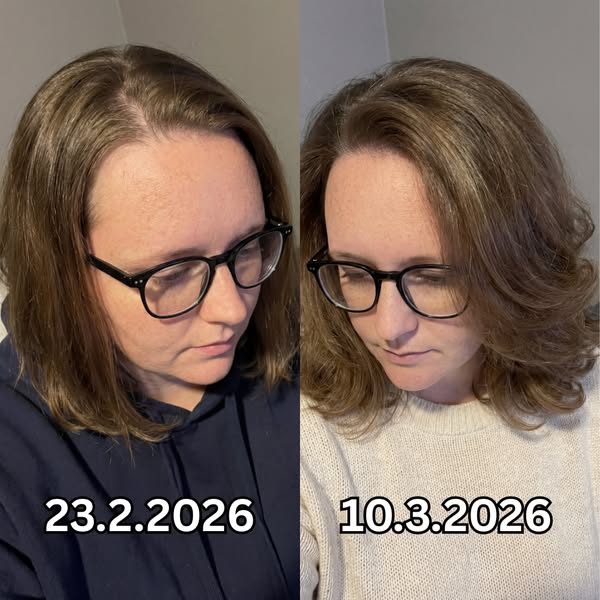 Healthy Hair Growth Secrets Facebook ad