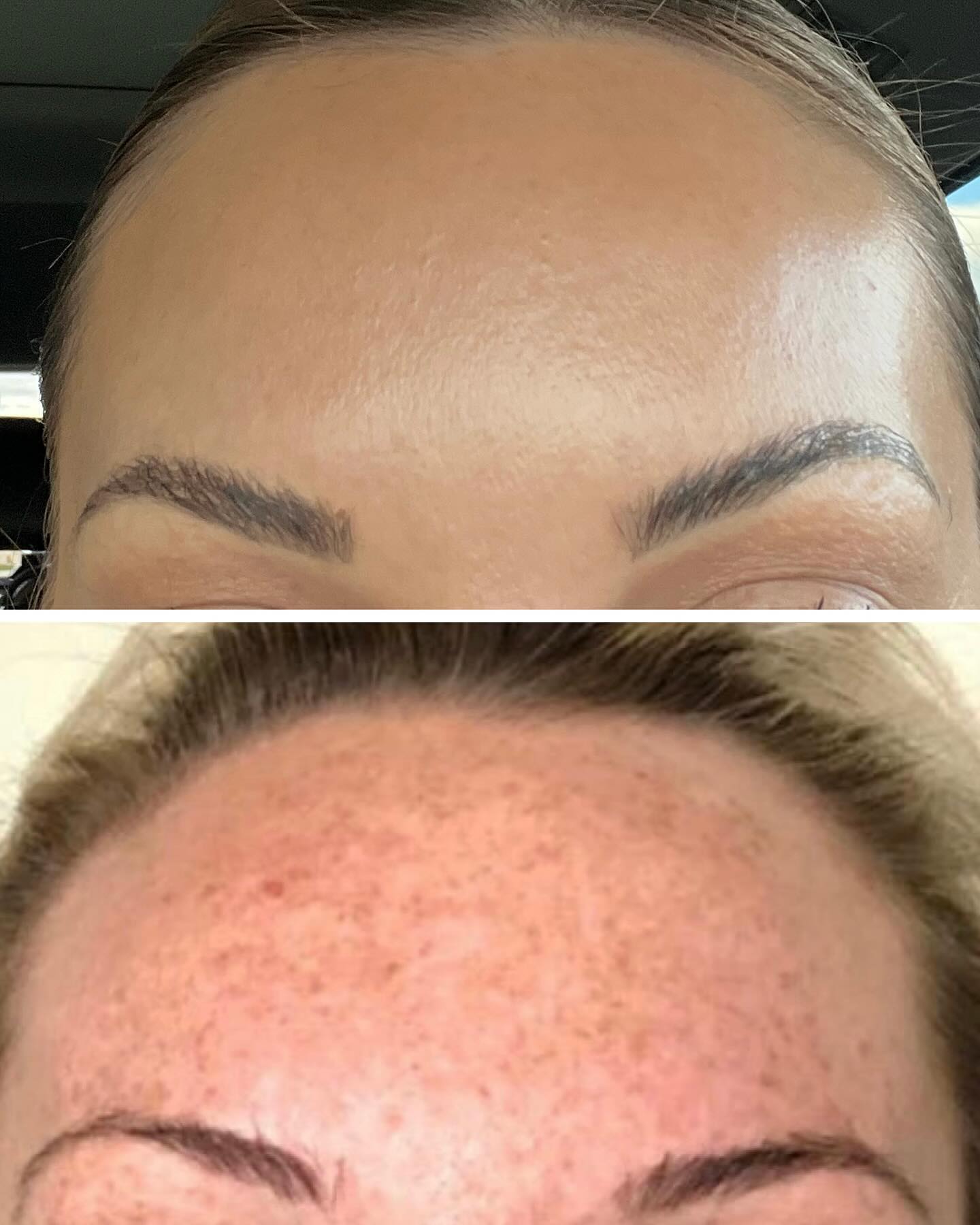 skin.by.di Facebook ad: For context: I’m naturally freckly & will always…