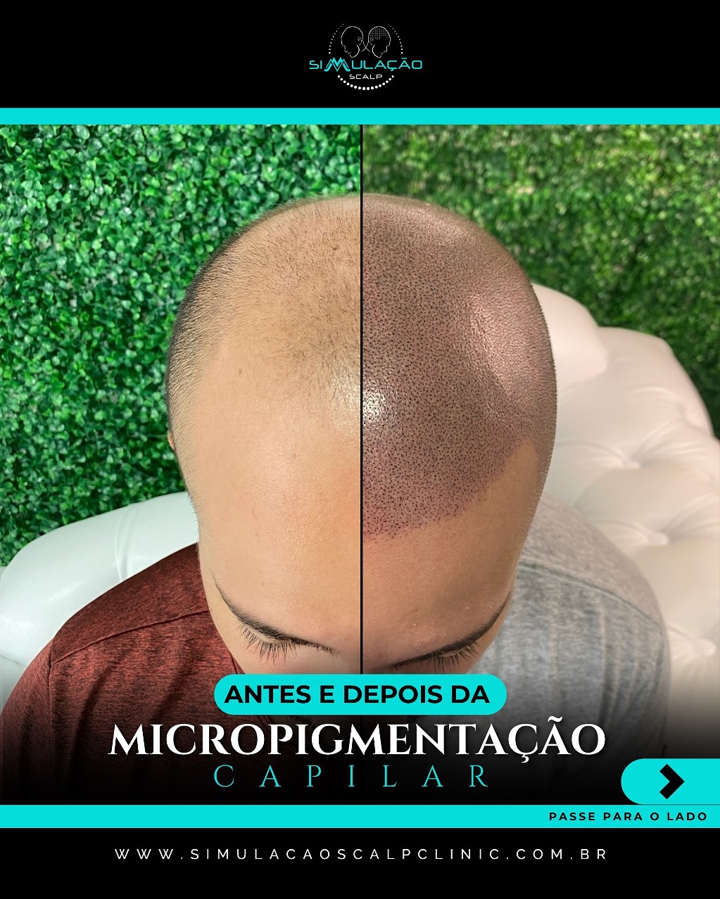Simulação Scalp  Facebook ad