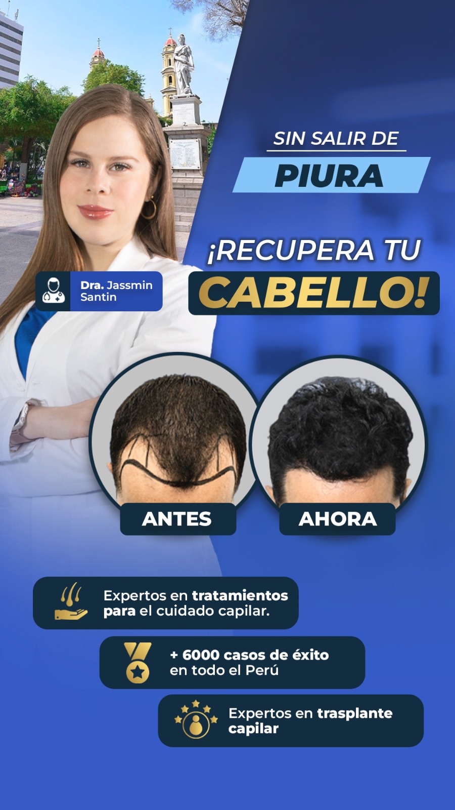 Perfection capilar - Trasplante capilar Facebook ad from Feb 28, 2026