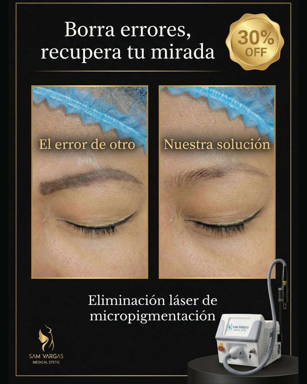 πππ§ππ«π¨ ππ¬πΓ©ππ’ππ¨ ππ§πππ π«ππ₯ πππ¦ πππ«π ππ¬ Facebook ad: Corrige errores de micropigmentaciΓ³n