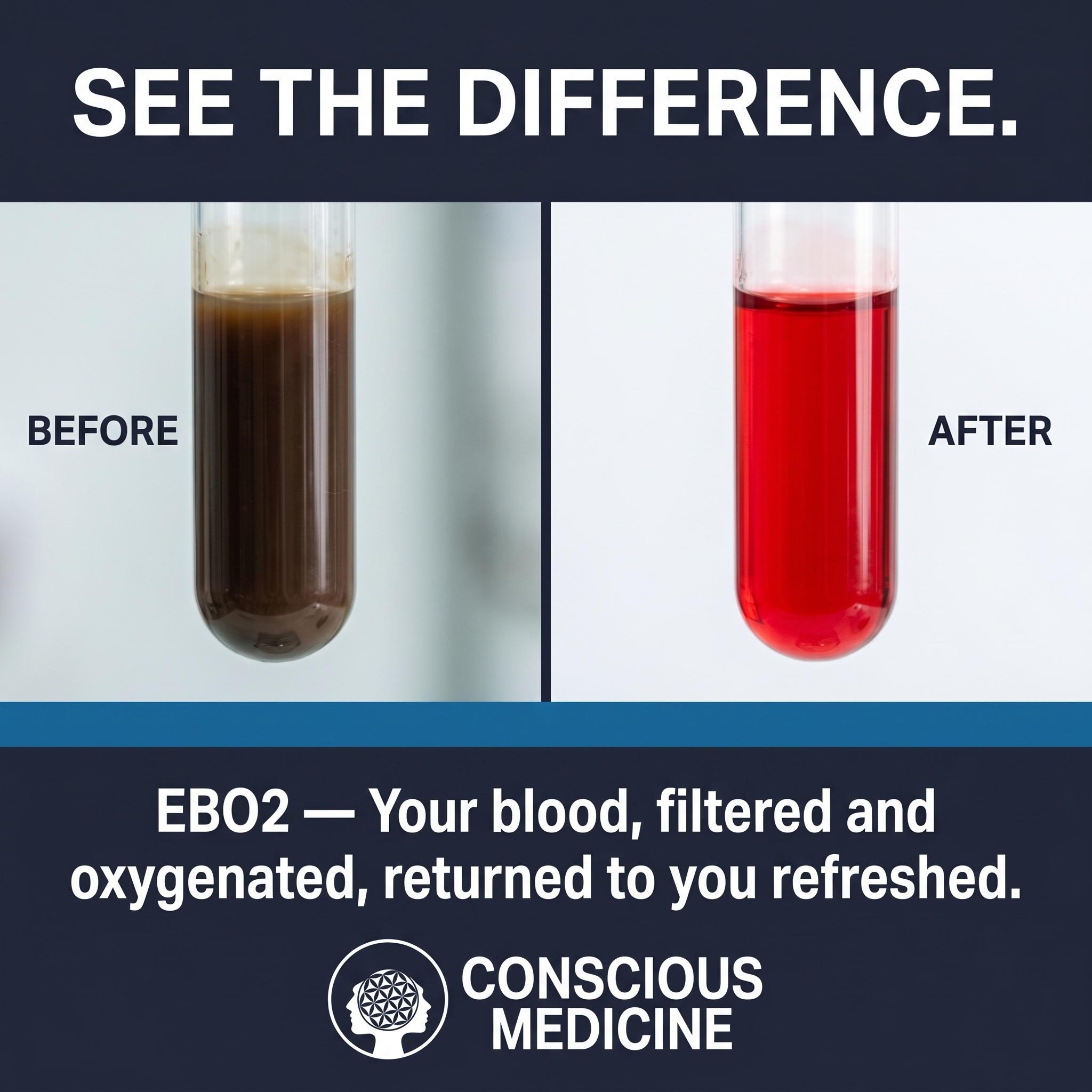 EBO2 Facebook ad