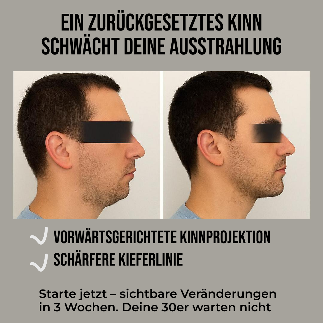 Mark Mewing Facebook ad